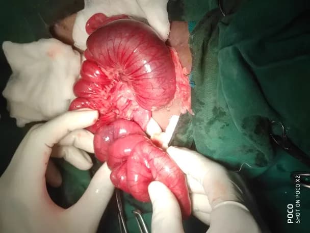 A linear foreign body (a rope entangled under tongue and in the intestnes) at Lakshmi Animal Care Clinic