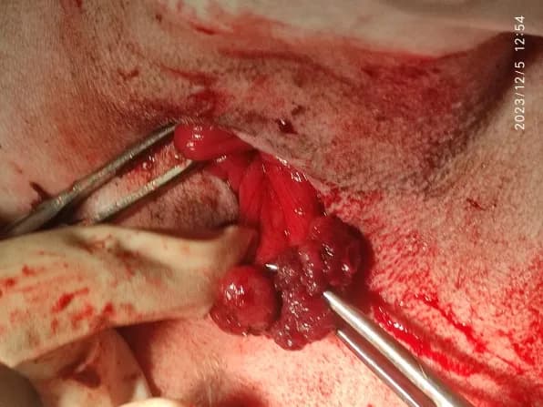 Tumour growth in rectum at Lakshmi Animal Care Clinic