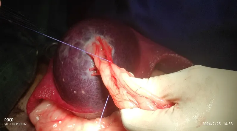 Tumour mass in body of the spleen at Lakshmi Animal Care Clinic