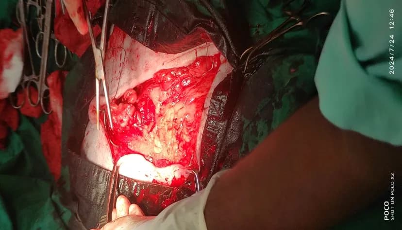 Mammary tumour in both caudal abdominal and inguinal glands (aka breast cancer) at Lakshmi Animal Care Clinic